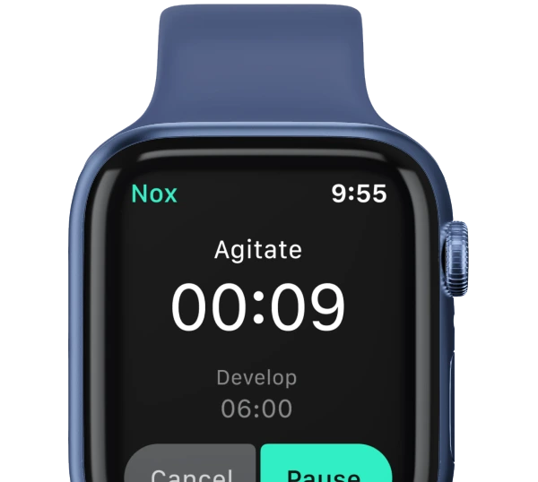 A screenshot of the Nox development timer app on the Apple Watch